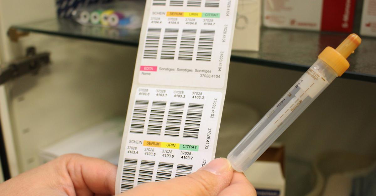 Main-Taunus-Kreis-bietet-kostenlose-HIV-Tests-an