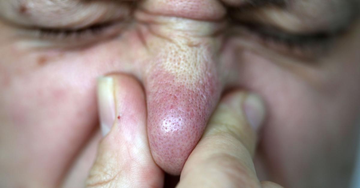 Der Untermain rümpft die Nase