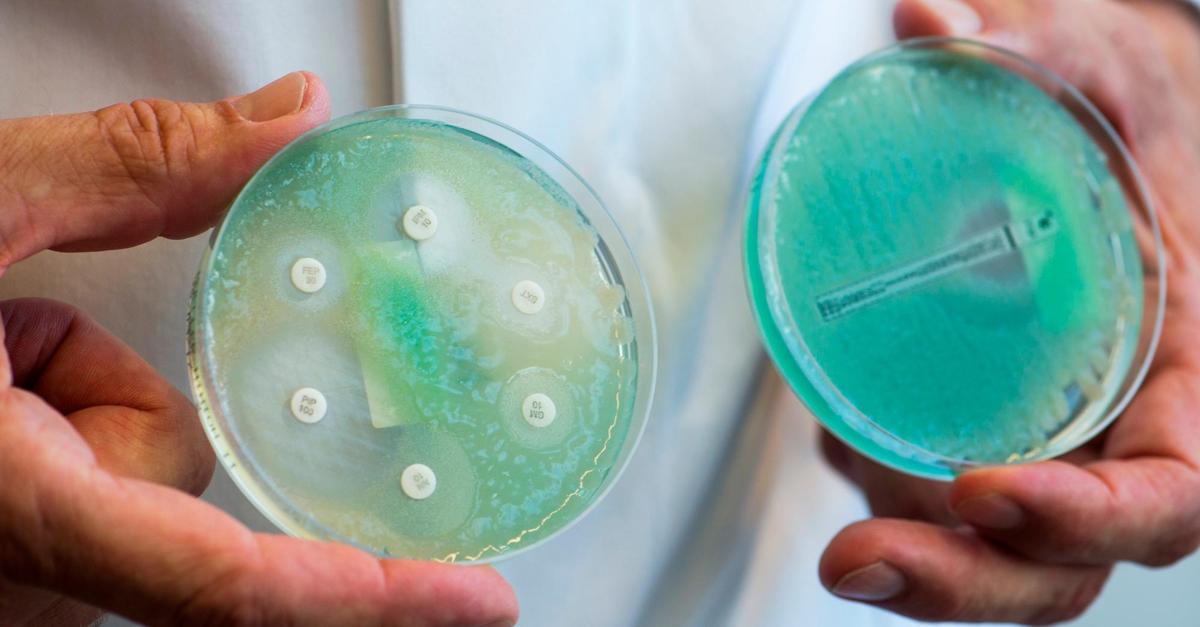 Antibiotikaresistente Bakterien: Boehringer kämpft gegen die „stille ...