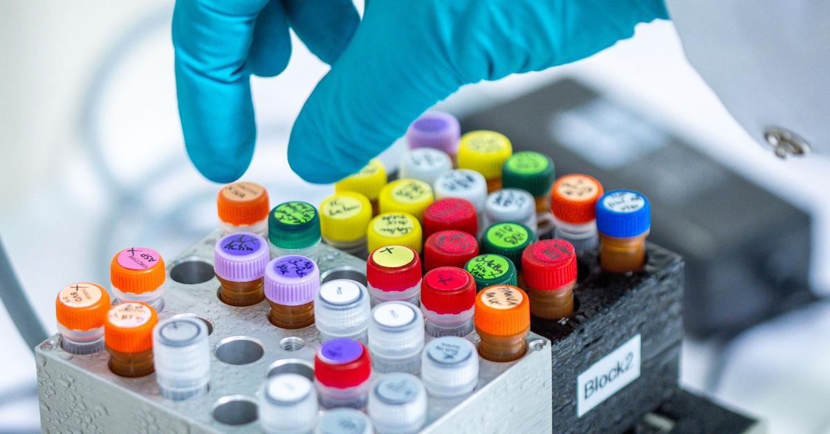 Zwei Menschen in Deutschland nach Ehec-Infektion gestorben