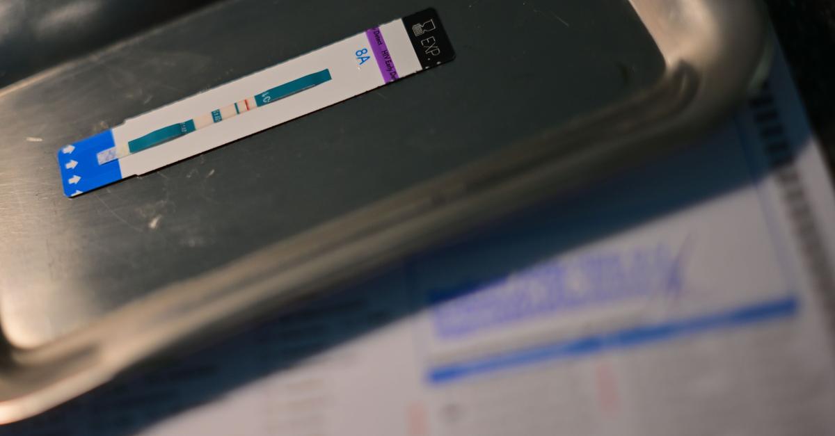 Schätzung: 2.300 neue HIV-Infektionen im Jahr 2024