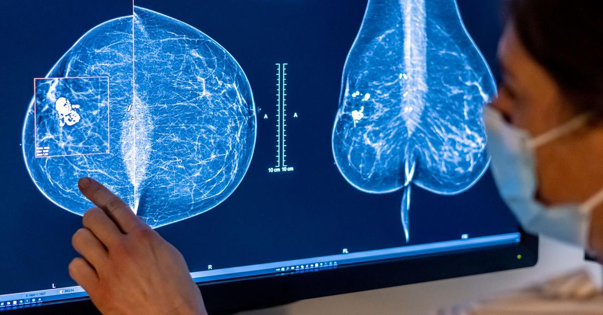 RKI-Fast-jeder-zweite-Deutsche-erkrankt-an-Krebs