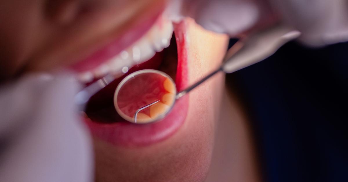 CDU-Wirtschaftsrat-Kassen-und-Sozialleistungen-streichen